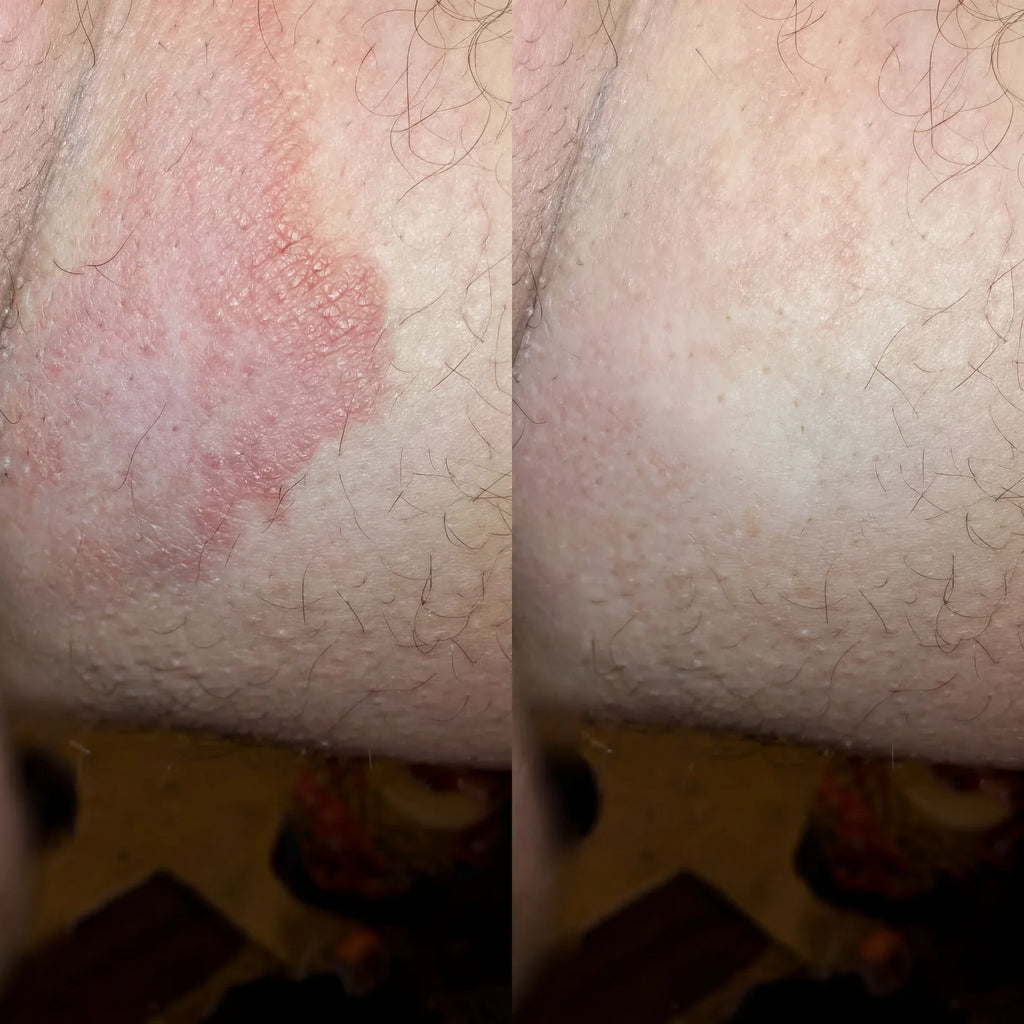 Veloma Antifungal Soap